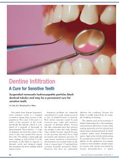 Dentine Infiltration: A Cure for Sensitive Teeth